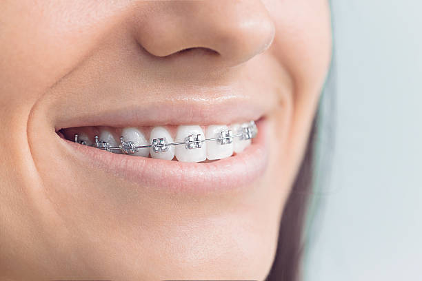 Trusted Fountainhead Orchard Hills, MD Dental Services Experts